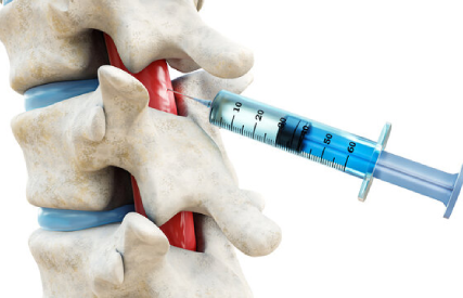 Spine Injections in Chennai